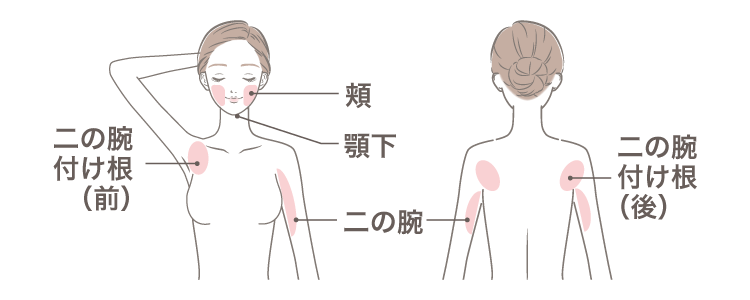 脂肪吸引の適応部位