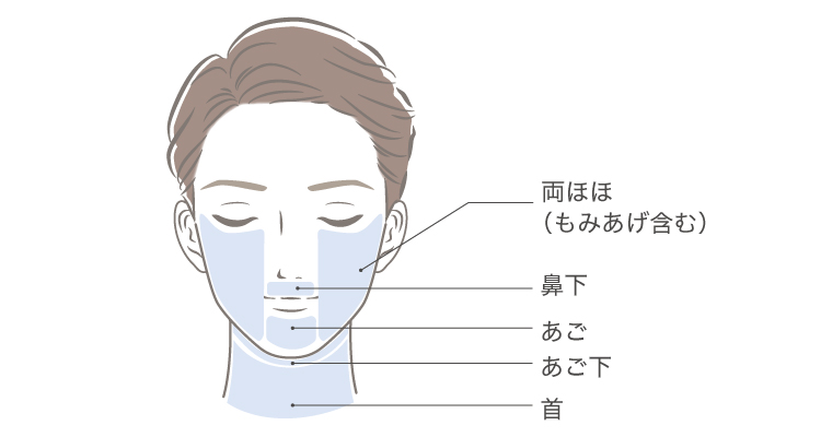 ヒゲ脱毛照射範囲